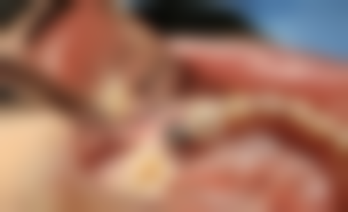 五、北京丹提斯口腔门诊部收费价格表