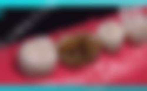 六、杭州口腔医院和睦门诊口碑如何?