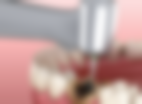 七、江苏苏州昆山嘉庆口腔医院地址电话及营业时间