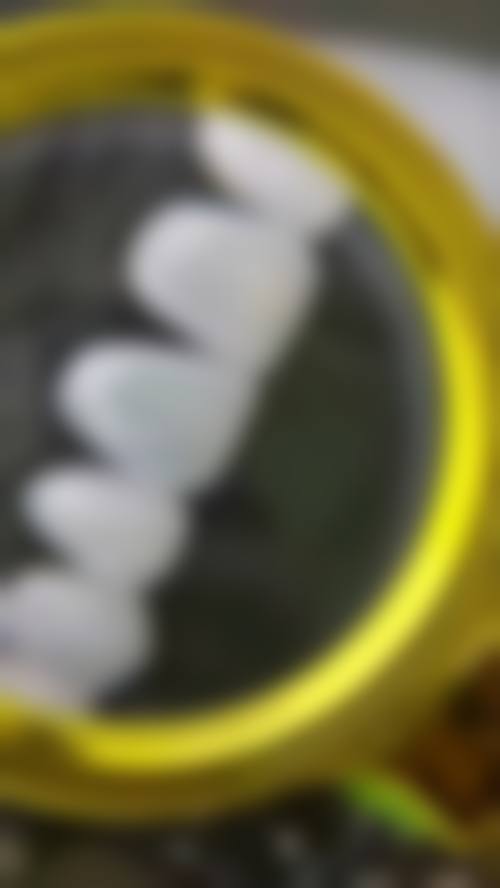 四、靖江刘超口腔诊所特色项目