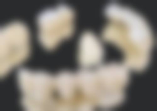 拔牙拍片的辐射剂量