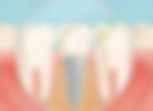 六、杭州市江干区陈有根口腔诊所口碑如何？