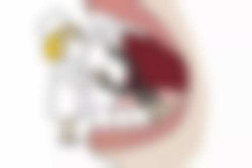 拔牙后多久可以装牙？这和假牙类型、创口愈合、个体差异等有关，答案全在这里！ 