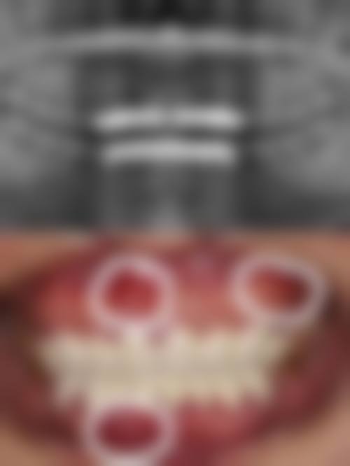 四、思茅区人杰口腔特色项目