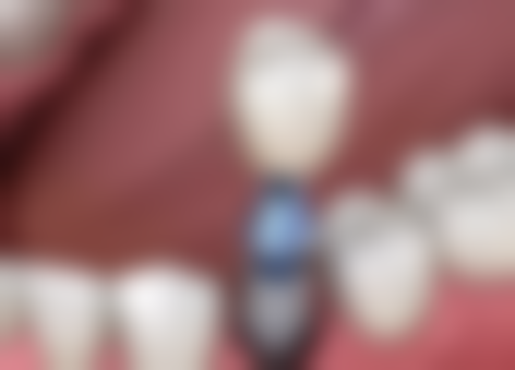 五、海口赵玉兰口腔诊所收费价格表