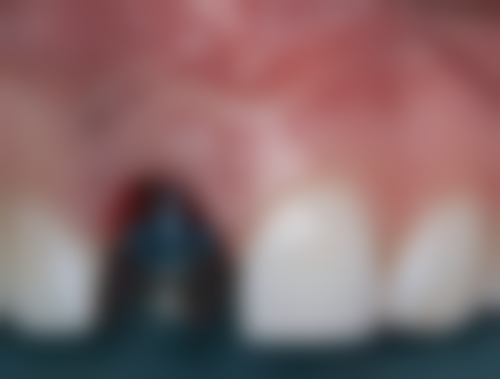 六、韶关爱雅仕口腔门诊部口碑如何？