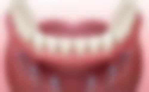 四、如皋爱雅口腔门诊特色项目