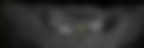 六、河北石家庄辛集赵增志口腔诊所口碑如何？