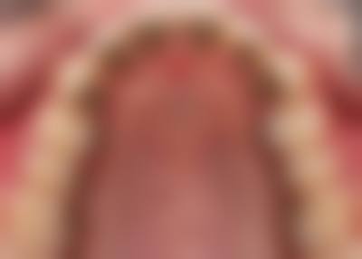 四、毕节七星关华睿口腔特色项目