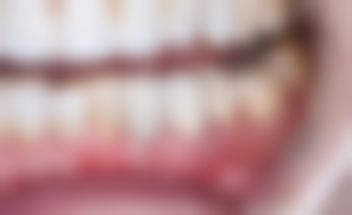 六、江苏南京德臣口腔口碑如何？