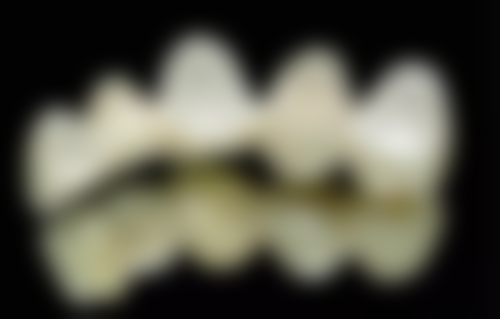 患者真实评价中的张草医生手术成效