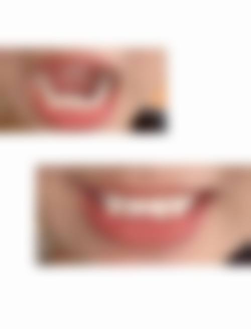 八、十堰华玉口腔门诊部怎么预约？