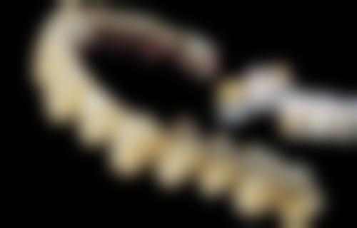 五、华北理工大学附属医院口腔正畸修复科收费价格表