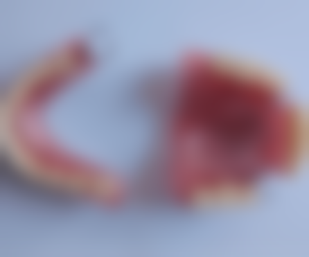 四、华北理工大学附属医院口腔正畸修复科特色项目