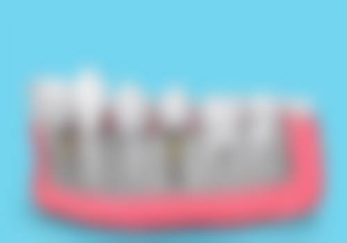 四、新桥口腔门诊部（玉双分院）特色项目