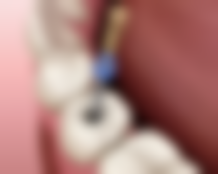 常见口腔问题及治疗方案