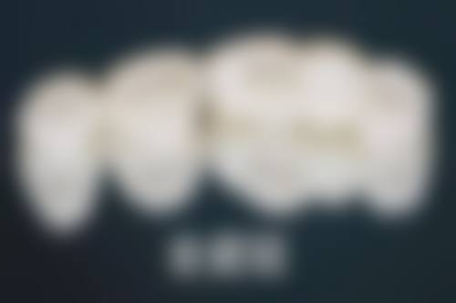 影响拔牙后镶牙时间的其他因素