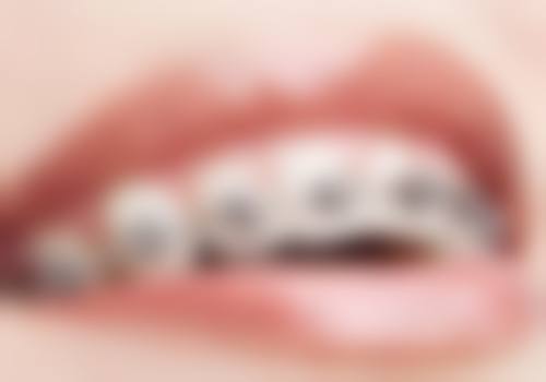 六、深圳维港口腔门诊部口碑如何？