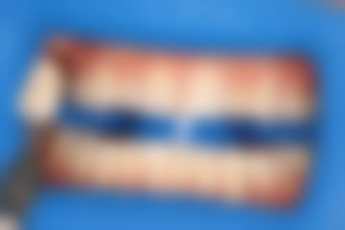 四、深圳维港口腔门诊部特色项目