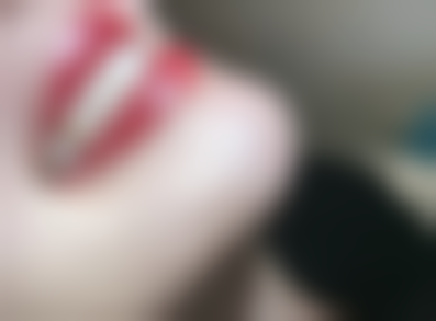 四、昆山伢伢口腔特色项目