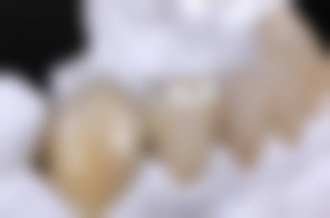 五、山东潍坊青州范玉博口腔收费价格表