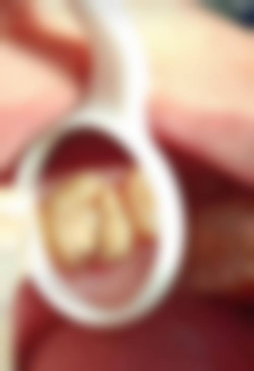 八、三河佳美口腔门诊部怎么预约？