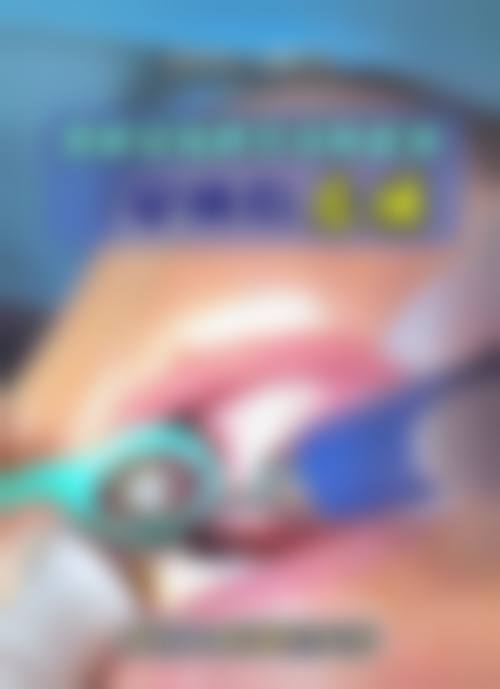 四、洛阳市妇幼保健院儿童口腔保健科特色项目