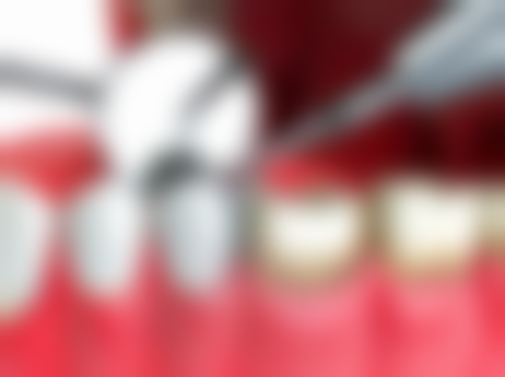 五、佛山大隐口腔门诊部收费价格表