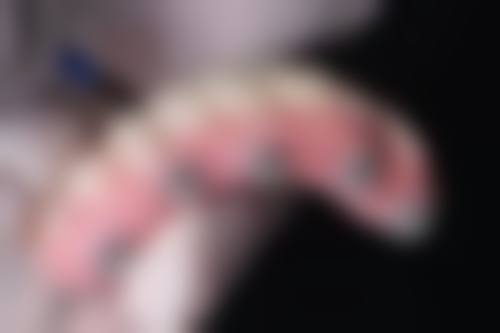 用什么洗牙齿才会变白？家用洗护如美白牙膏、牙贴，专业治疗如冷光美白等方法可供选择！ 