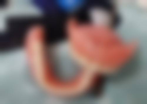 四、太原熙朵植发特色项目