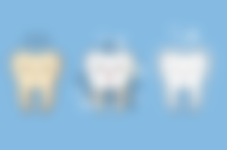 五、浙江衢州戴益夏口腔收费价格表