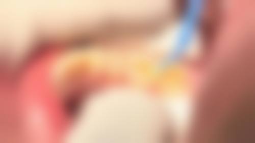 六、新余杨婷口腔口碑如何？