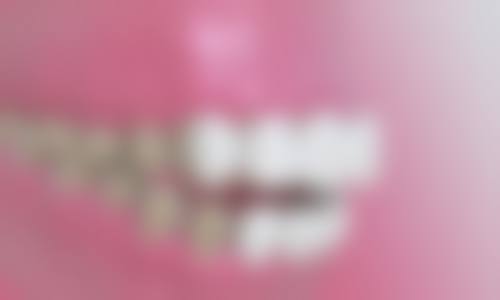 八、洛阳植雅口腔医院怎么预约?