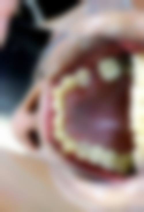 四、漯河市中 心医院口腔颌面外科特色项目