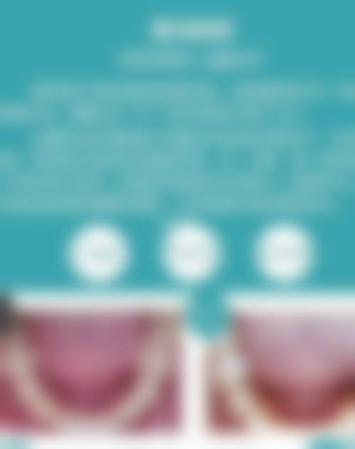 四、上海博耀口腔门诊特色项目
