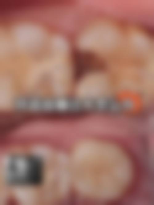 五、大连葆嘉口腔门诊部收费价格表