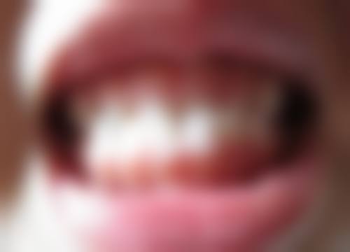 六、杭州成全口腔余杭门诊部口碑如何?