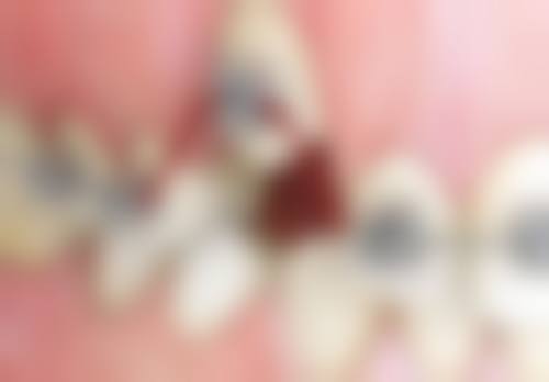 八、桂林瑾帆口腔诊所怎么预约?