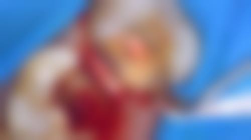 八、深圳颜秀娟口腔诊所怎么预约?