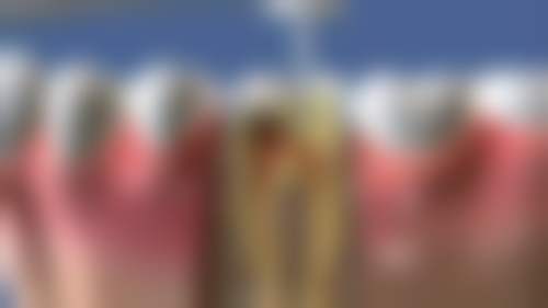 六、深圳市口腔医院口碑如何?