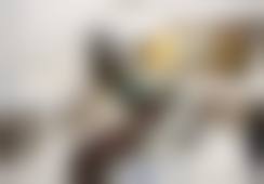 二、乌鲁木齐优佳贝口腔冯宗疆医生擅长项目