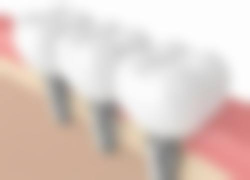 五、广东东莞东坑雅至美口腔收费价格表