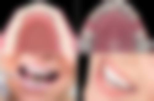 八、烟台龙口（北京柏旭口腔）怎么预约？