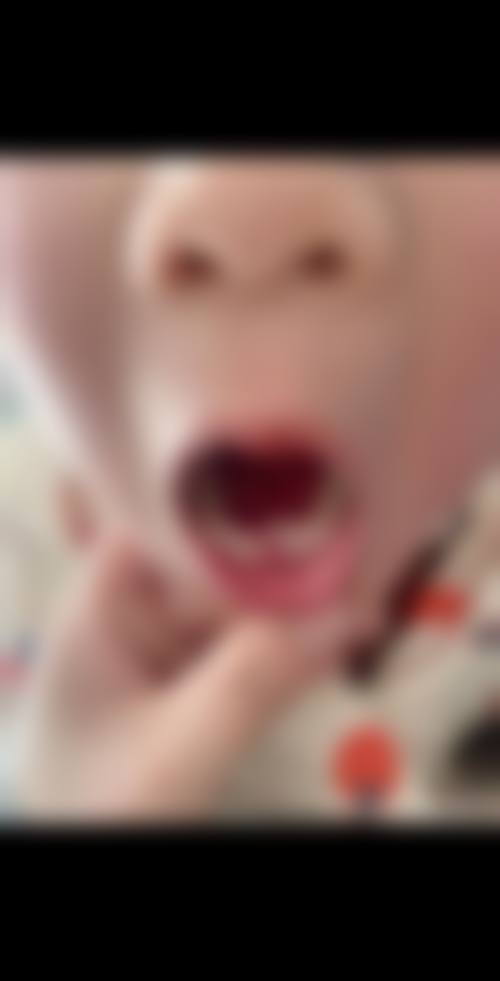 六、瑞齿固德口腔门诊部（栖霞店）口碑如何？