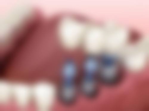 七、营口市鲅鱼圈区美一洁口腔地址电话及营业时间