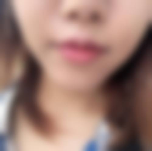 患者真实评价:口碑如何验证?
