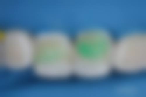 常见问题解答