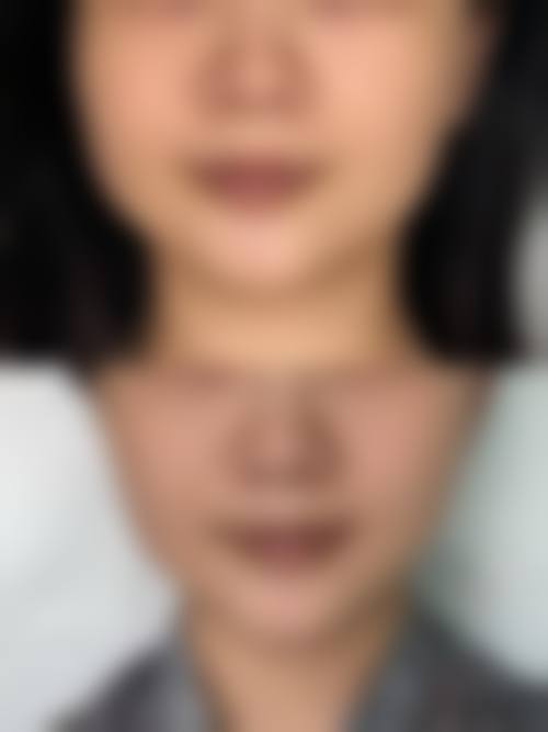 擅长项目详解:雷晓东医生擅长做我需要的项目吗?