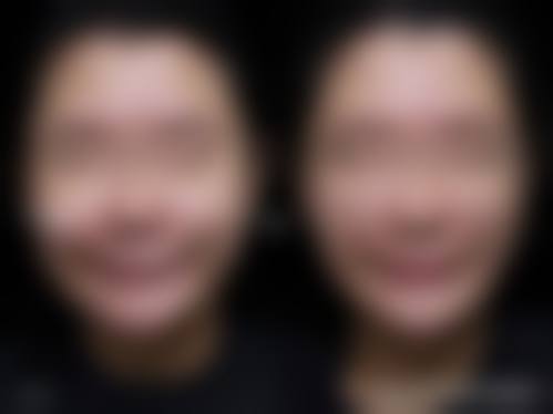 预约优惠活动:有什么隐藏限制吗?