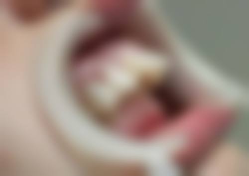 六、绍兴越中口腔蔡玉玲医生口碑评价及真人实例反馈